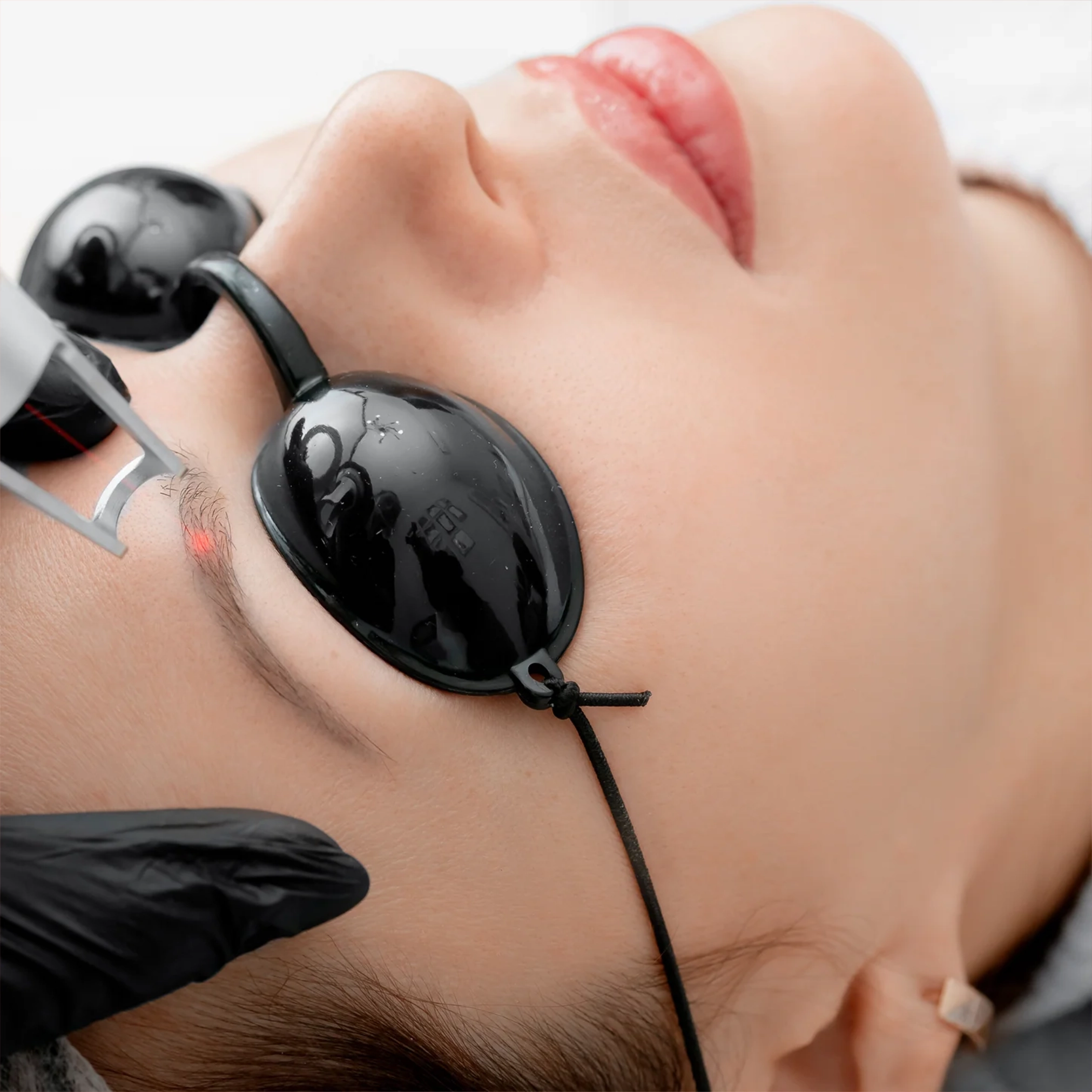 banner-laser-removal